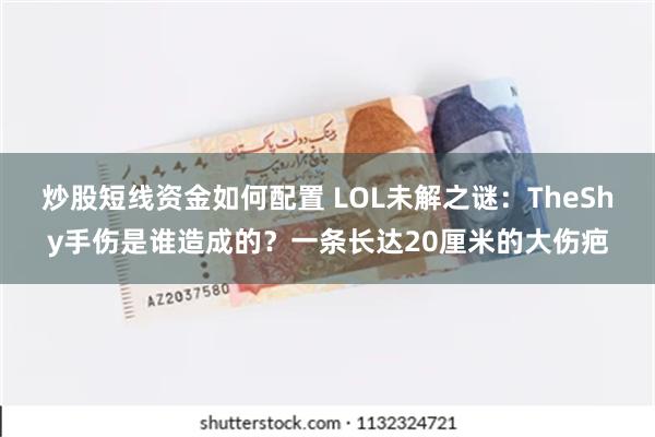 炒股短线资金如何配置 LOL未解之谜：TheShy手伤是谁造成的？一条长达20厘米的大伤疤